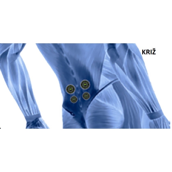 Protibolečinski obliž - Univerzalen 